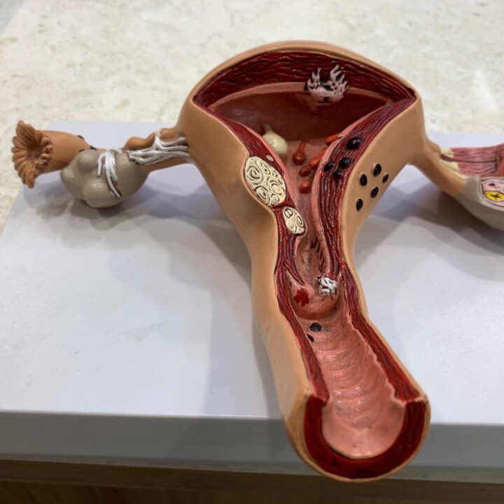 난임원인, 연령대마다 먼저 볼 것이 다릅니다 – 자윤한의원 인천송도점